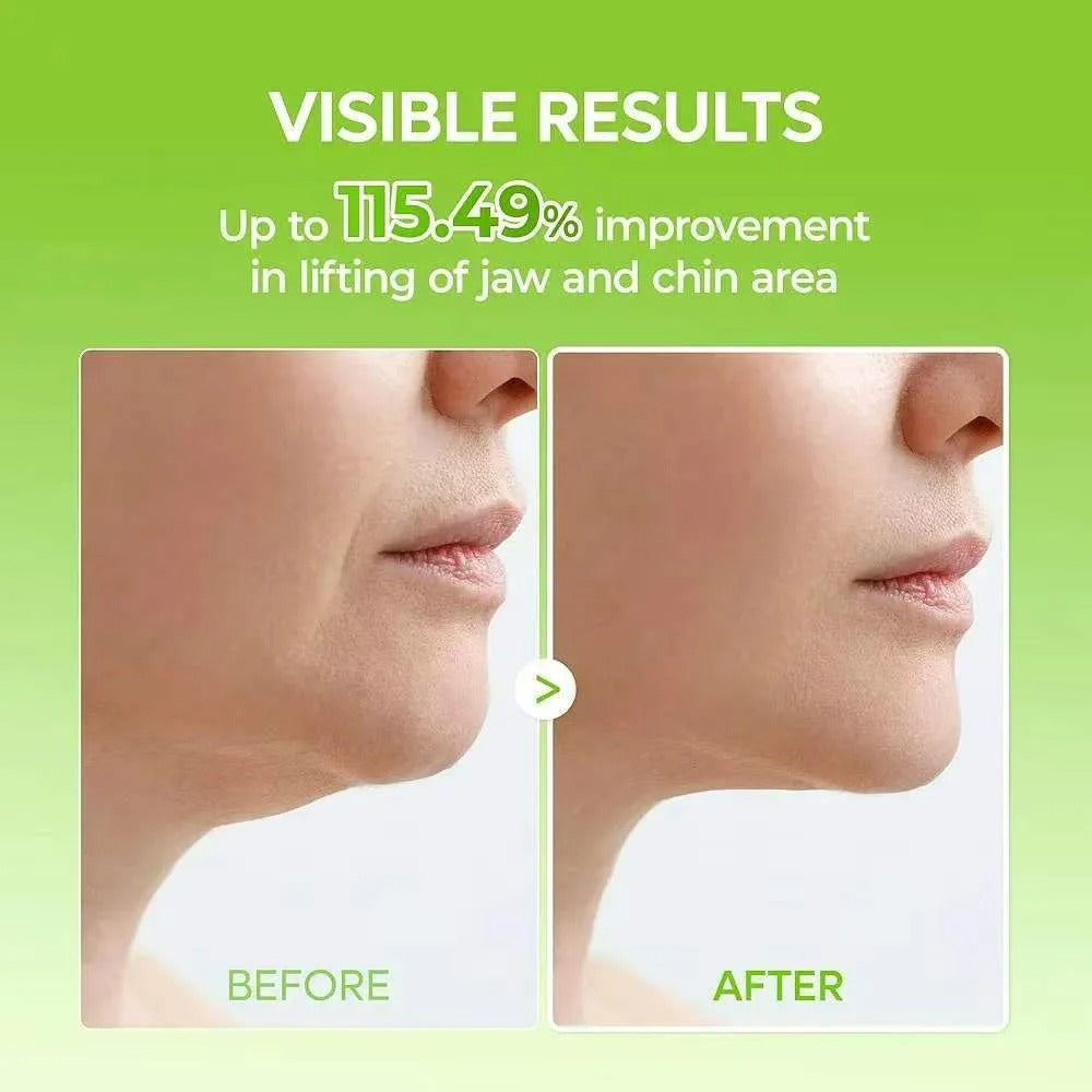 Double Chin Mask