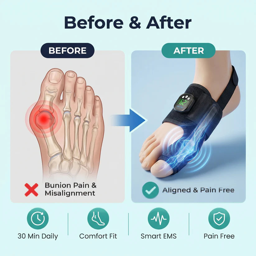 Alverin &CO. Pro — EMS Bunion Corrector