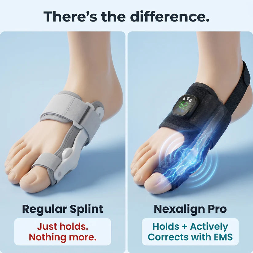 Alverin &CO. Pro — EMS Bunion Corrector